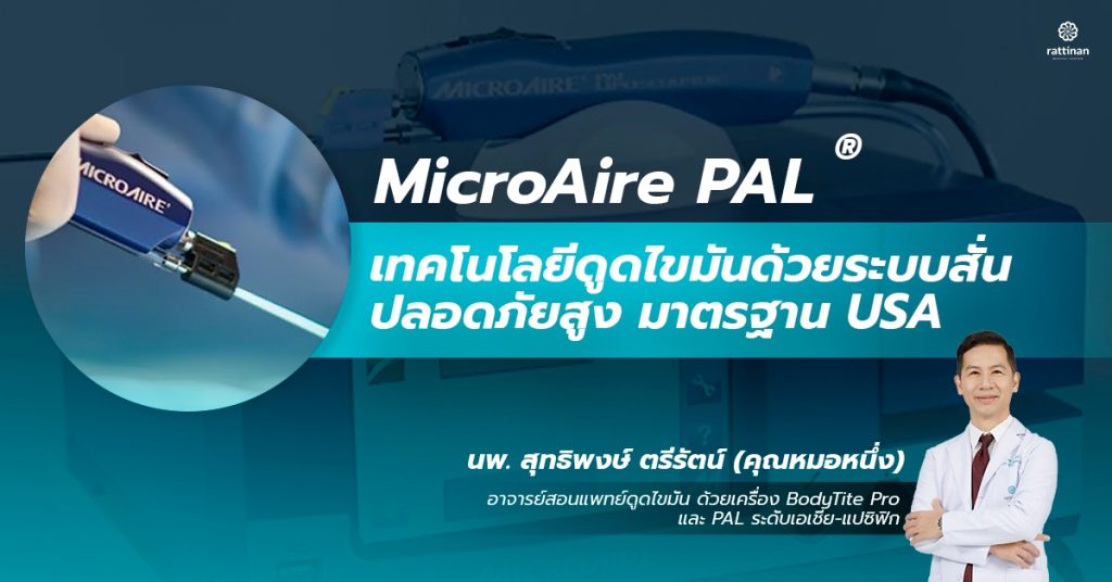 MicroAire PAL® เทคโนโลยีดูดไขมันด้วยระบบสั่น ปลอด