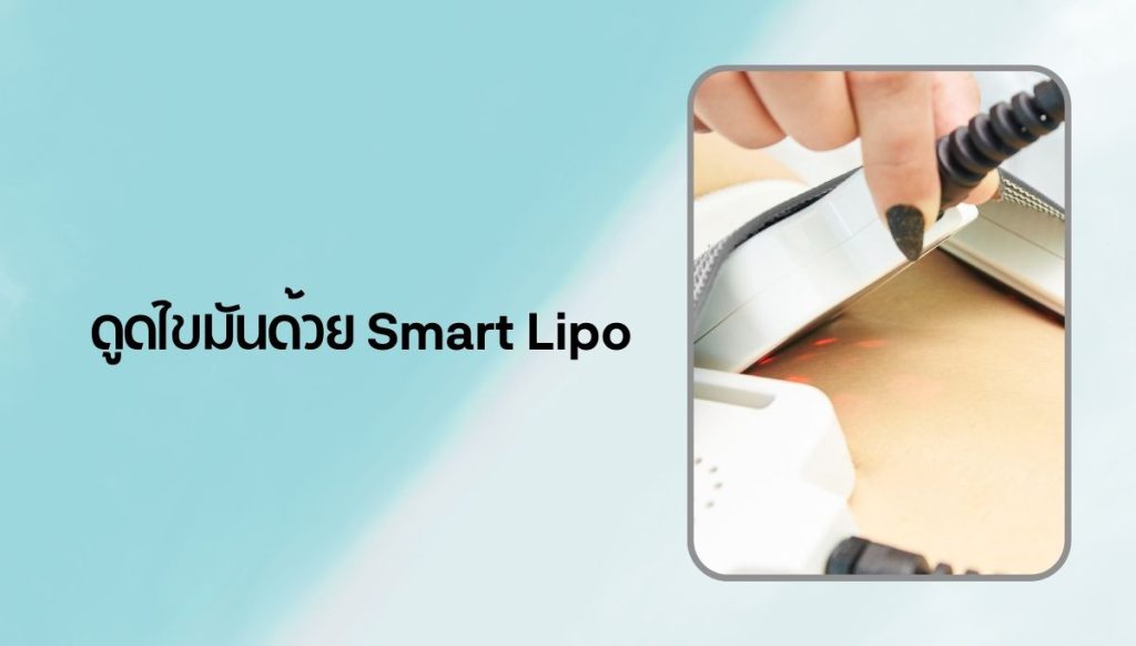 smart lipo