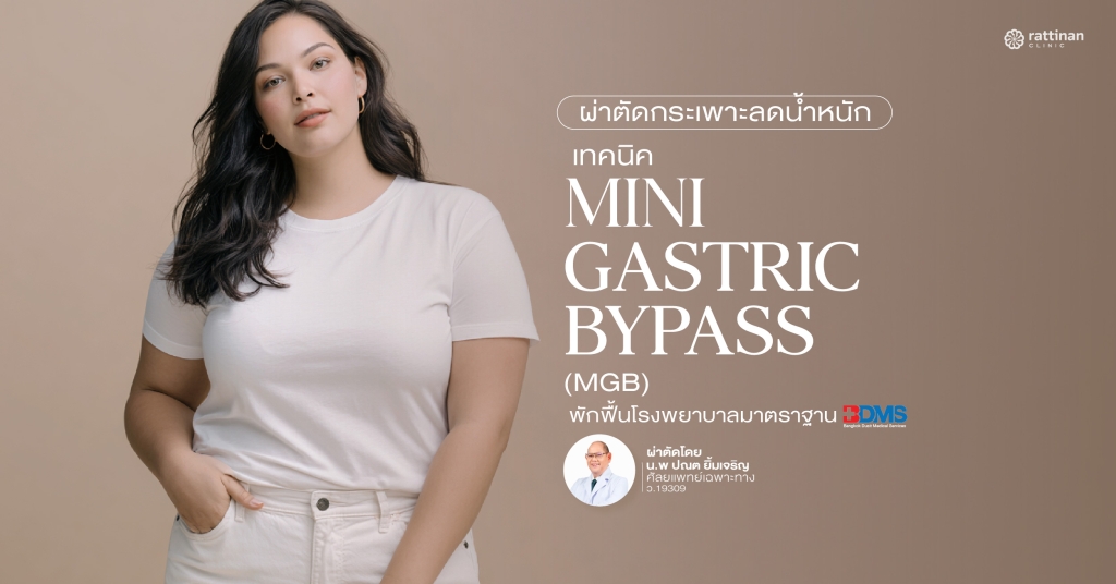 ผ่าตัดกระเพาะลดน้ำหนัก เทคนิค Mini Gastric Bypass (MGB)