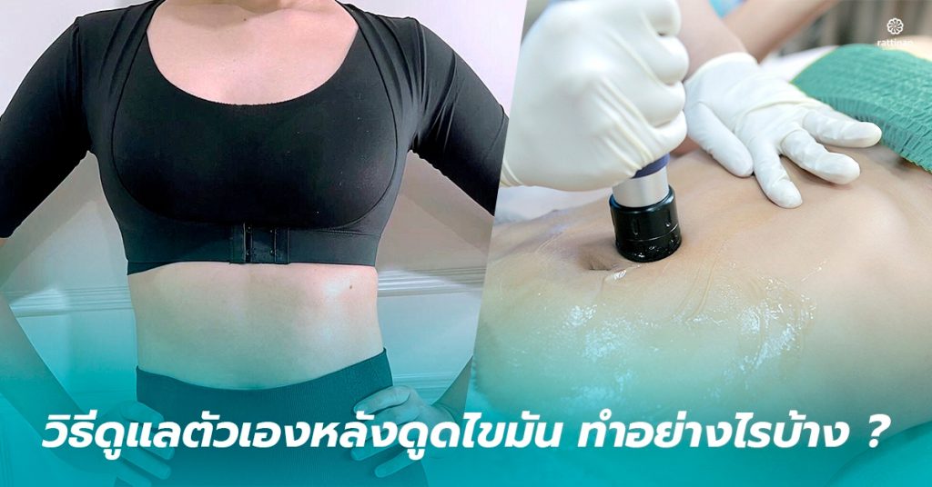 วิธีดูแลตัวเองหลังดูดไขมัน
