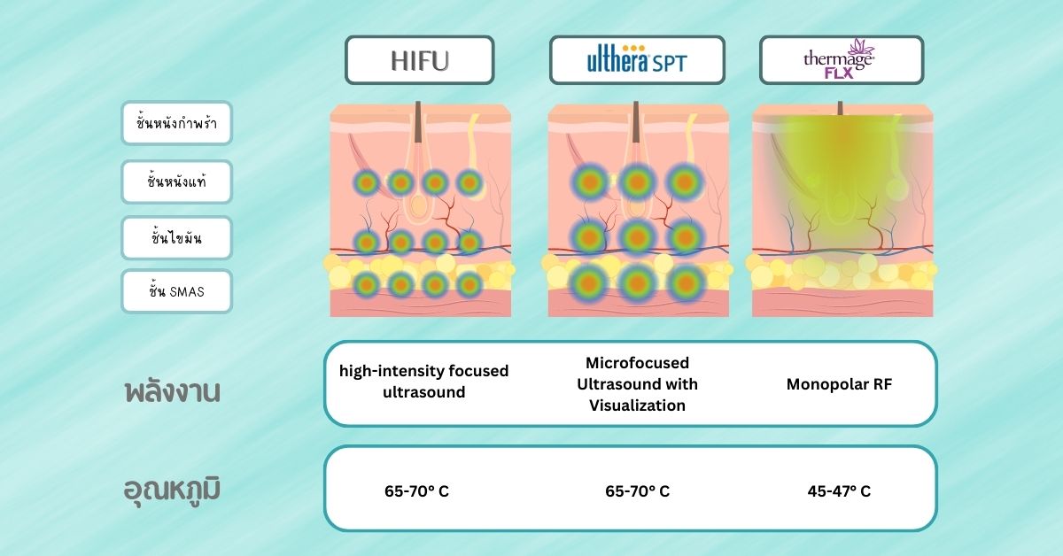 ทำอะไรดี ระหว่าง Thermage, HIFU และ Ulthera