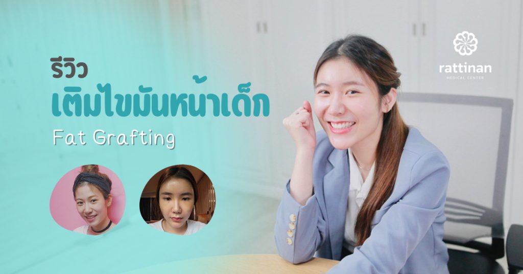 รีวิว เติมไขมันหน้า