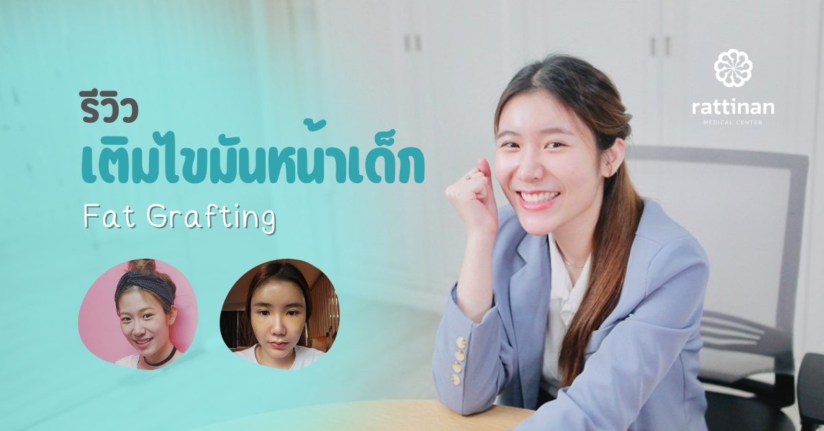 รีวิว เติมไขมันหน้า