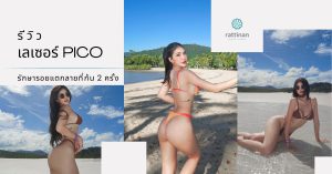 รีวิว เลเซอร์ Pico รักษารอยแตกลาย