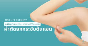 ผ่าตัดยกกระชับต้นแขน - arm lift surgery