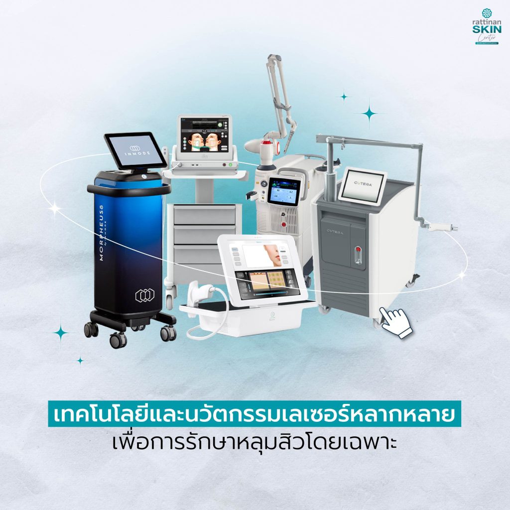 รักษาหลุมสิว มีเครื่องครบ รักษาตามปัญหาได้ตรงจุด