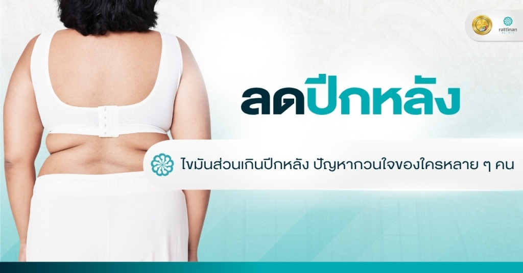 ลดปีกหลัง