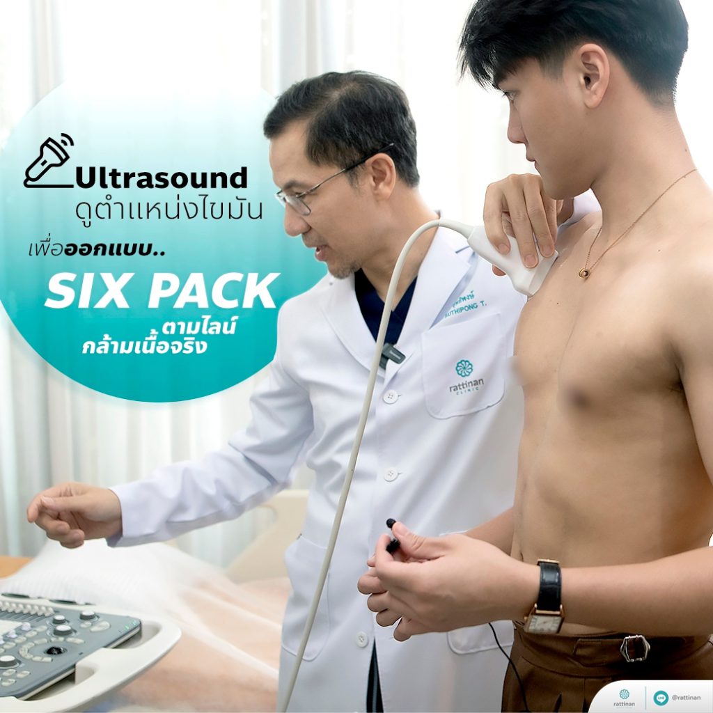 six pack liposuction อัลตร้าซาวด์กล้ามเนื้อและไขมัน