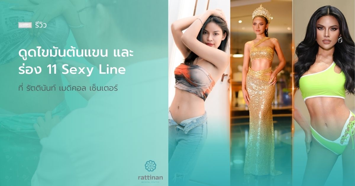 รีวิว ดูดไขมันต้นแขน และร่อง 11 Sexy Line