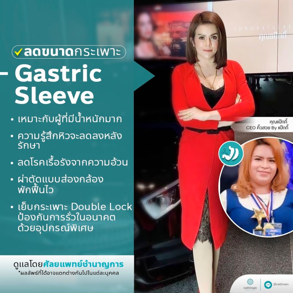 รีวิวลดน้ำหนัก รักษาโรคอ้วนด้วยการผ่าตัดกระเพาะ