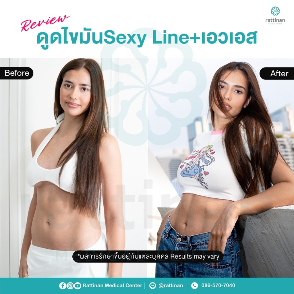 Anntonia Porsild - แอนโทเนีย โพซิ้ว ดูดไขมัน Sexy Line