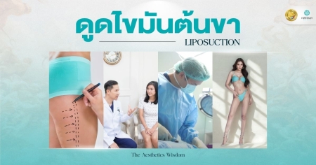 ดูดไขมันต้นขา
