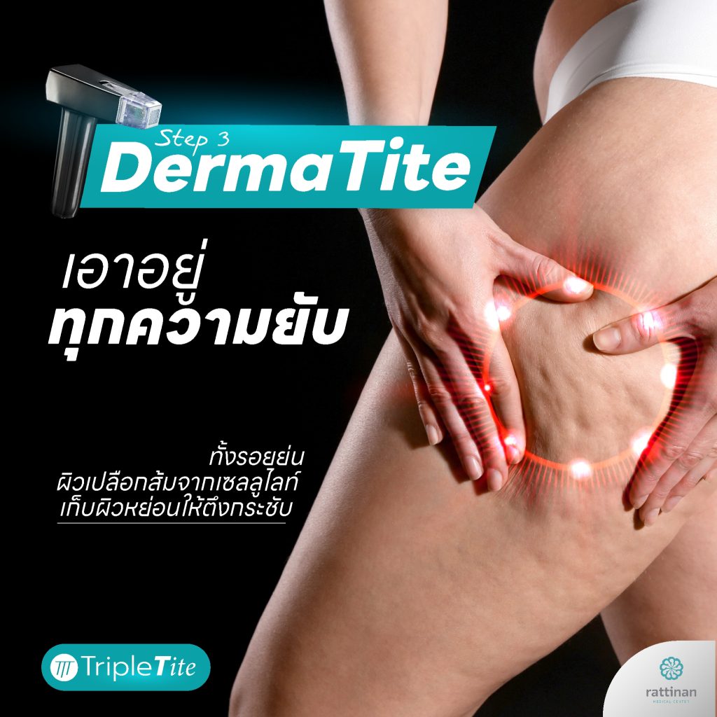 ดูดไขมัน DermaTite