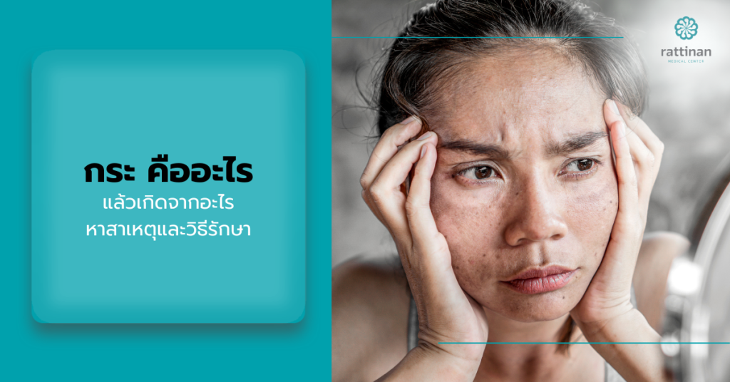 กระ คืออะไร
