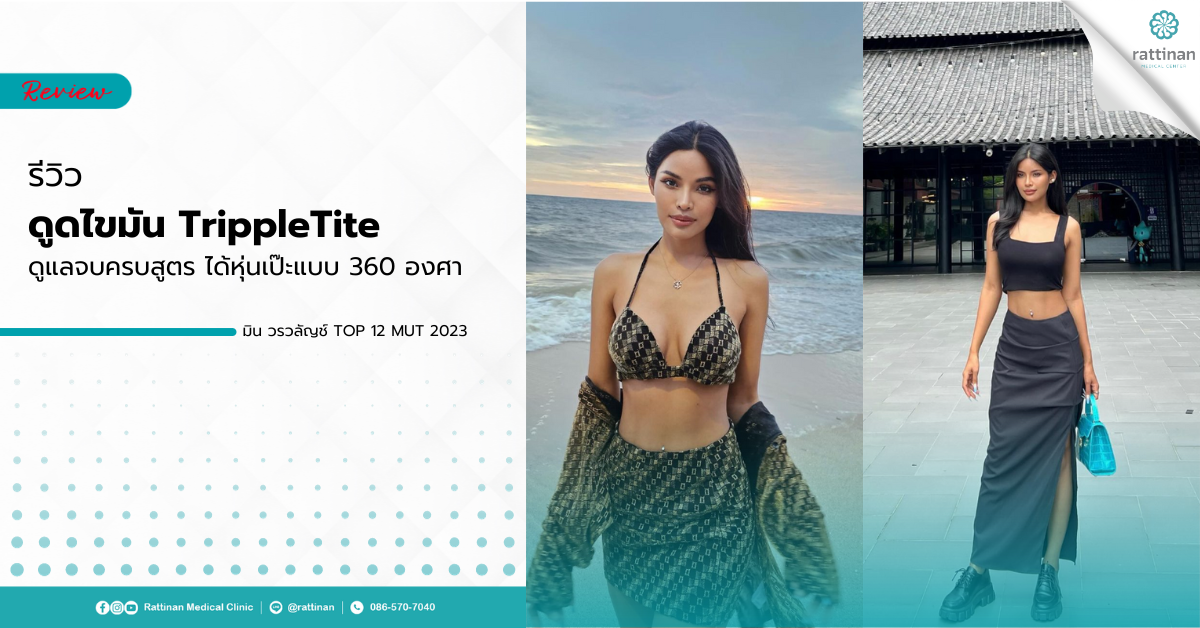 ดูดไขมัน TrippleTite