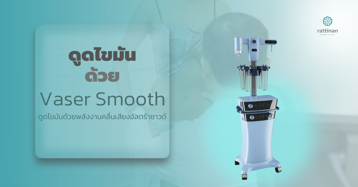 ดูดไขมัน ด้วย Vaser Smooth
