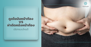 ดูดไขมันหน้าท้อง VS ผ่าตัดหนังหน้าท้อง