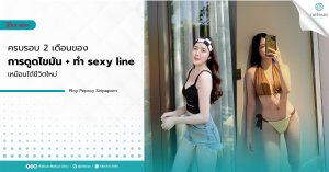 ครบรอบ 2 เดือนของการดูดไขมัน + ทำ sexy line