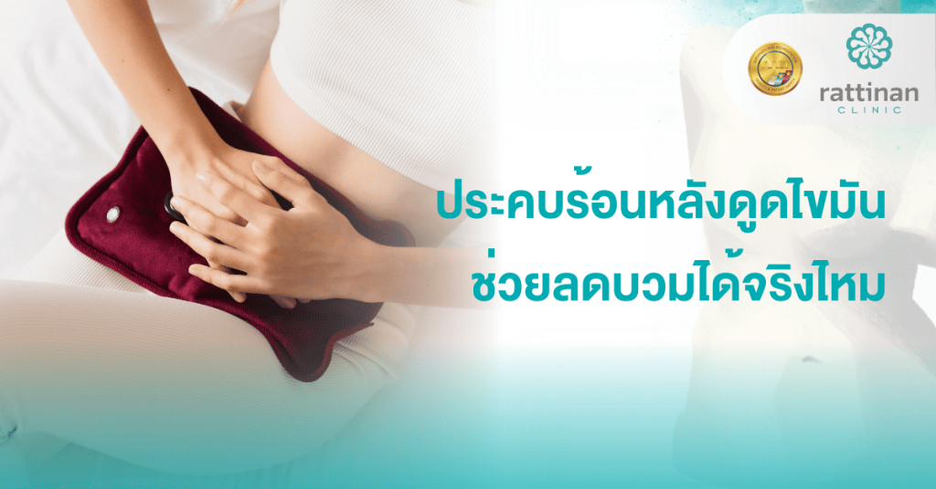ประคบร้อนหลังดูดไขมัน