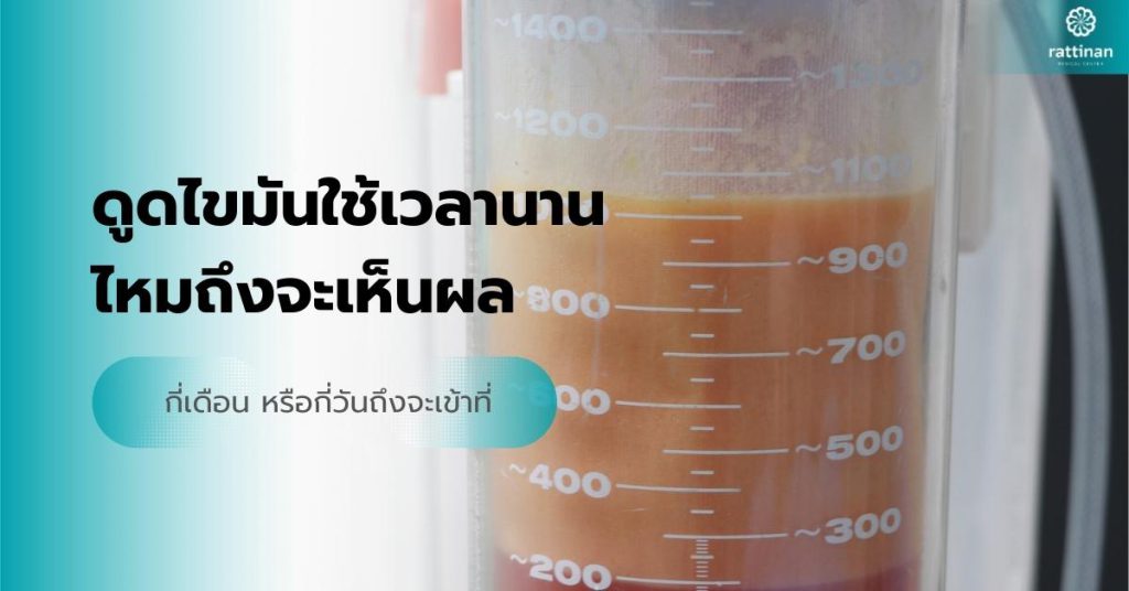 ดูดไขมันใช้เวลานานไหมถึงจะเห็นผล