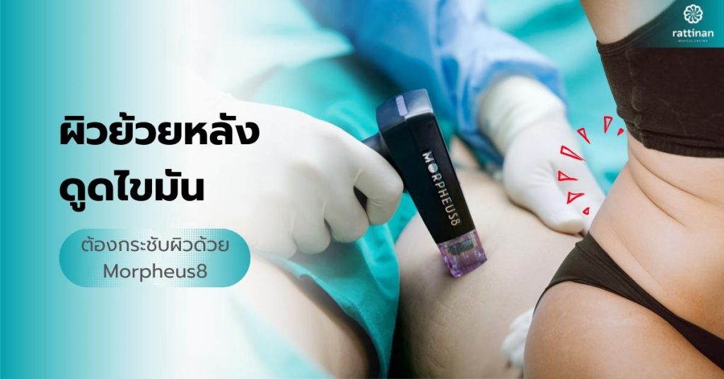 ผิวย้วยหลังดูดไขมัน
