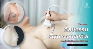 รีวิว ศัลยกรรม Gynecomastia