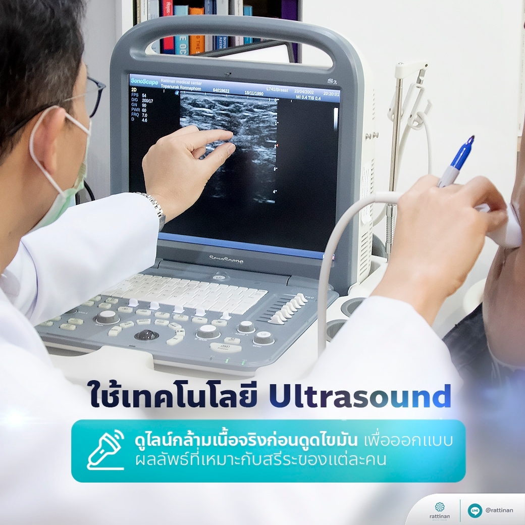 ดูดไขมัน Ultrasound