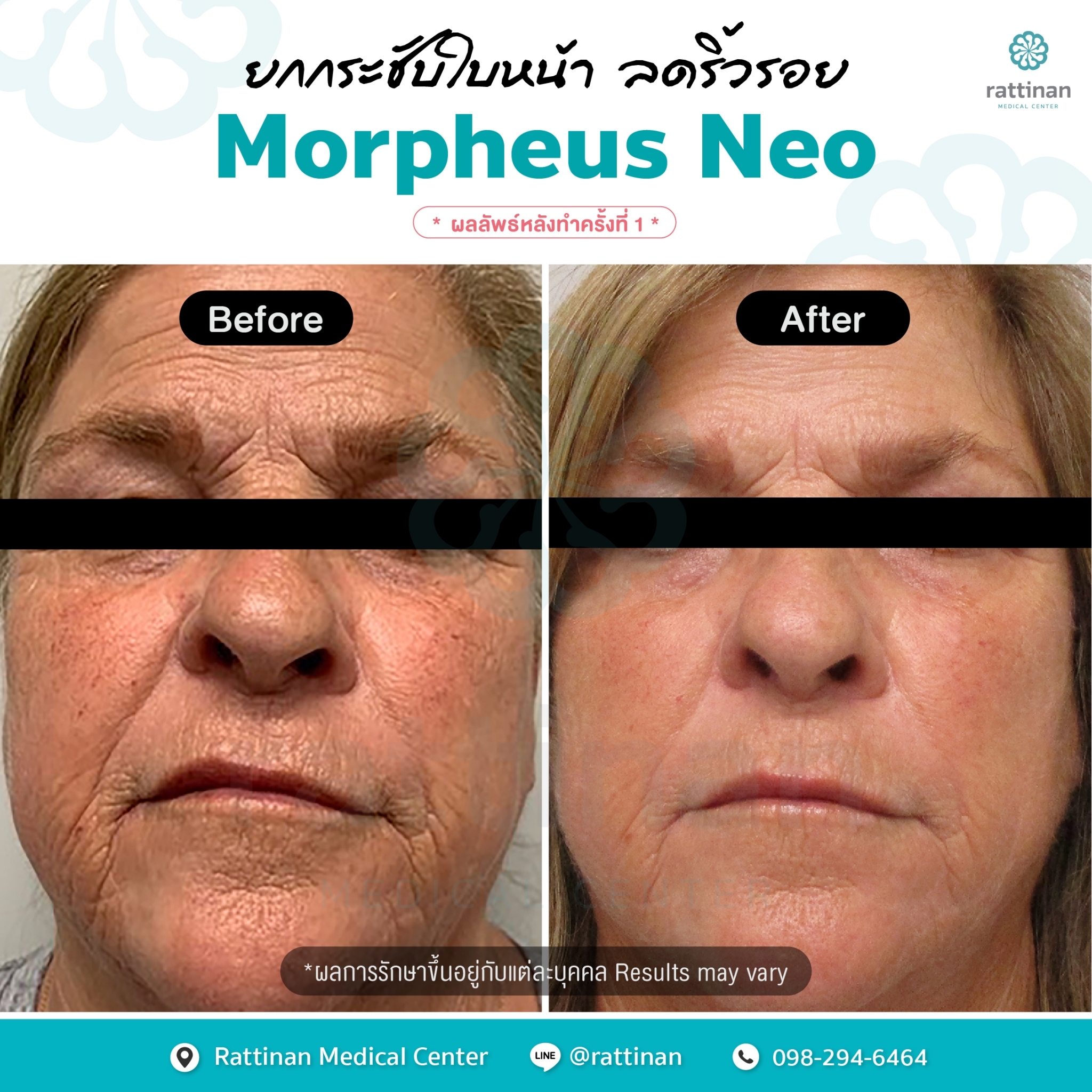 ภาพรีวิว Morpheus NEO