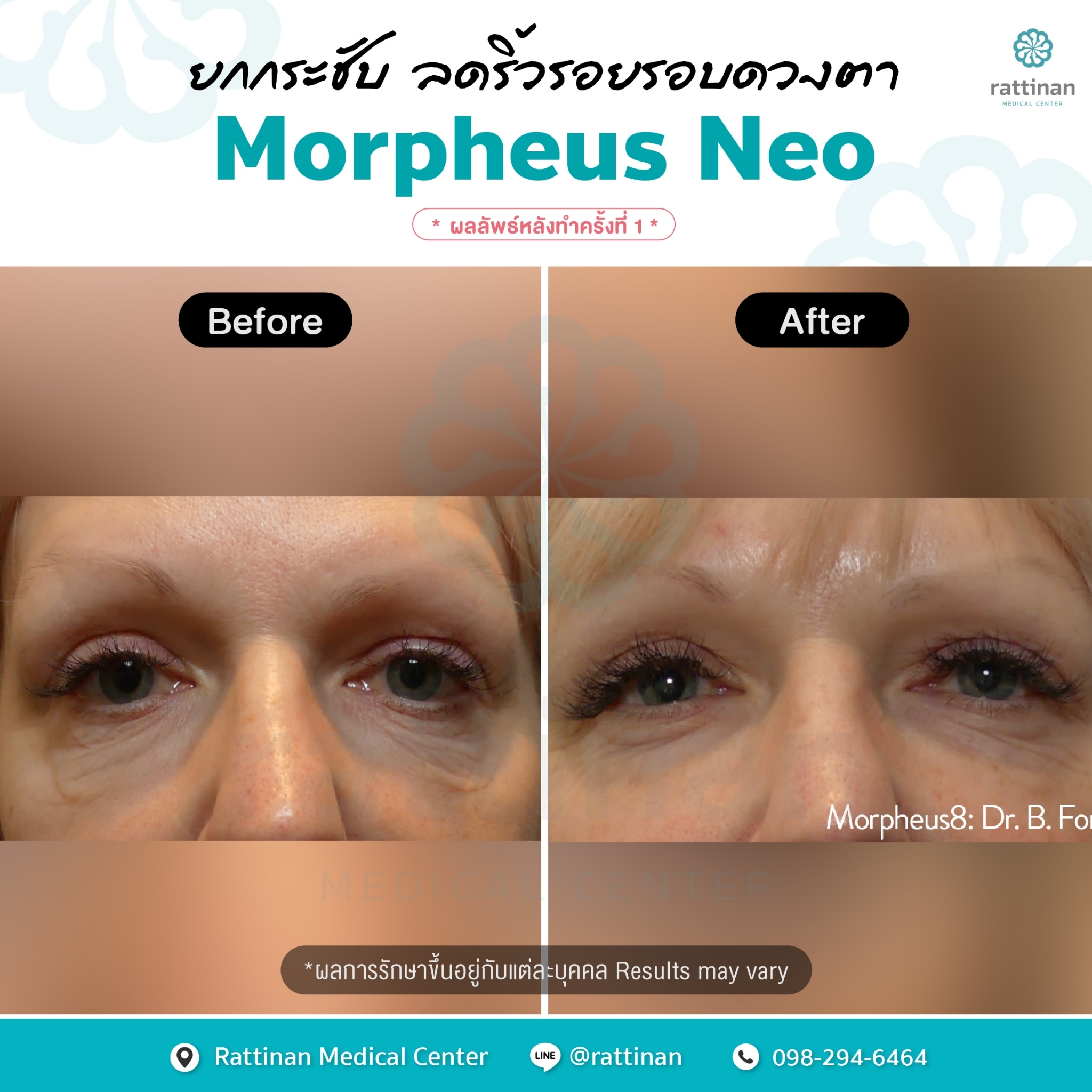 ภาพรีวิว Morpheus NEO 1