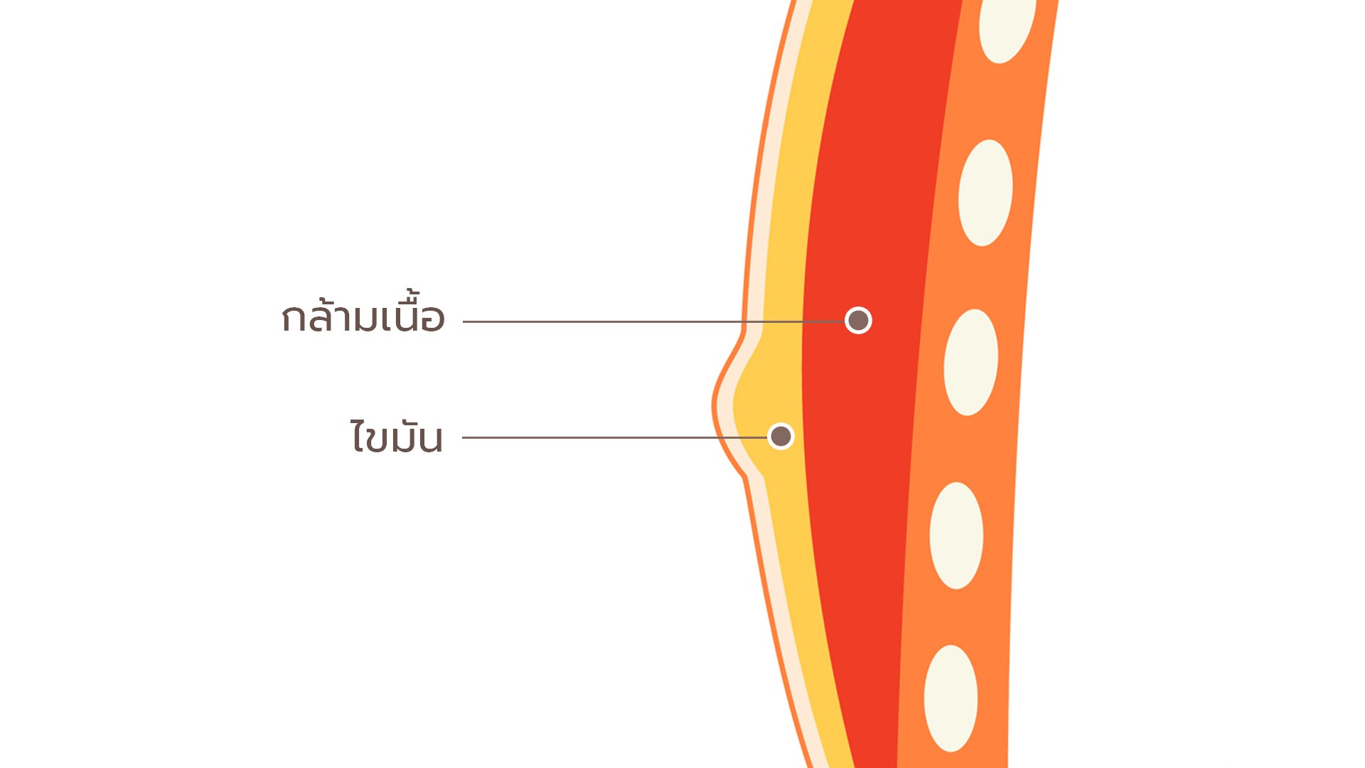 Gynecomastia ออกกำลังกายหายไหม 1