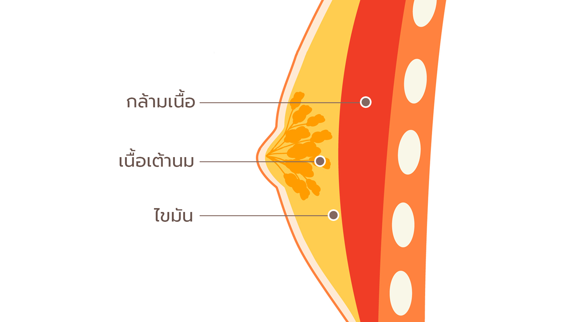 Gynecomastia ออกกำลังกายหายไหม ภาวะเต้านมโตในผู้ชาย