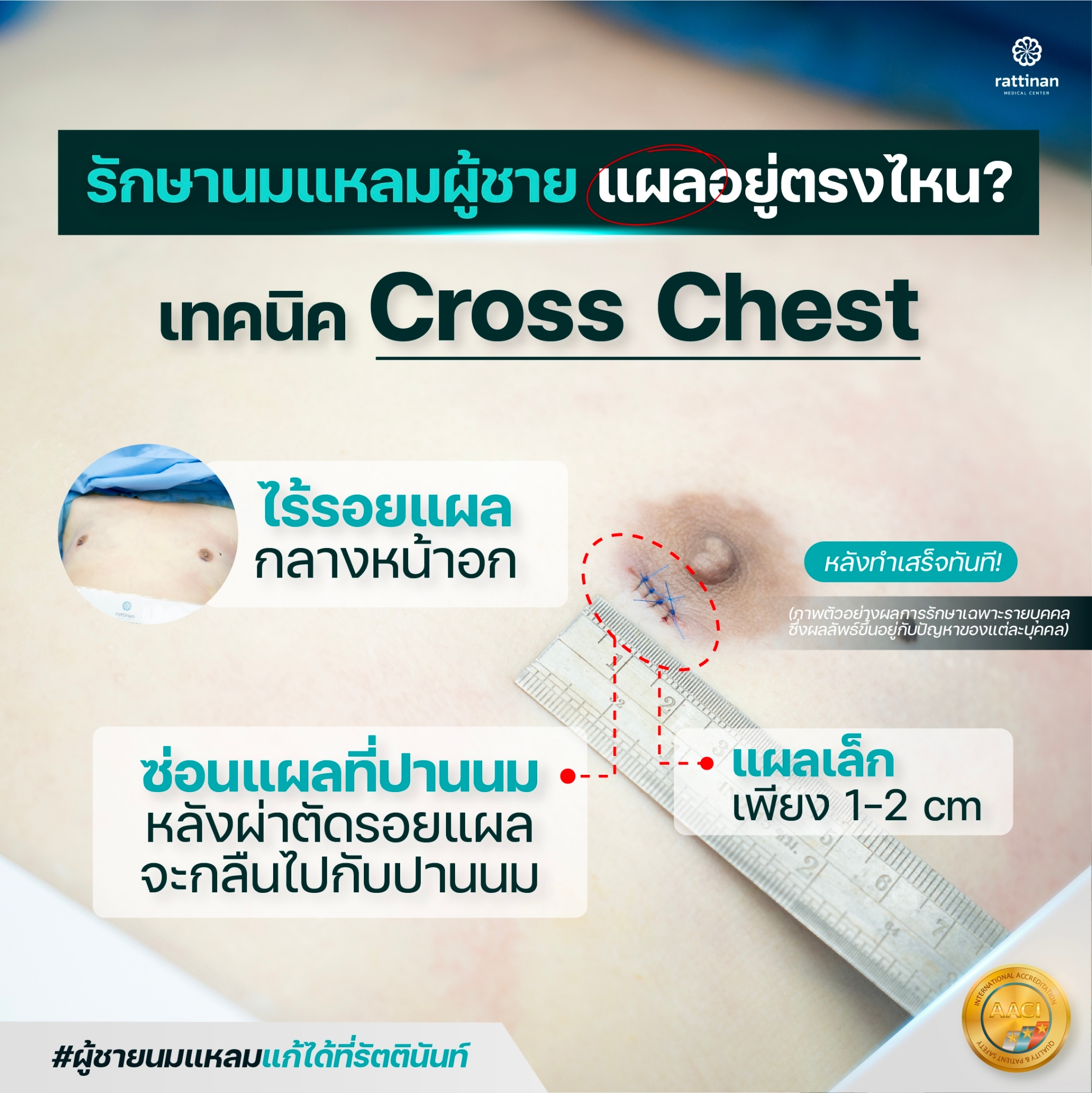 Cross Chest