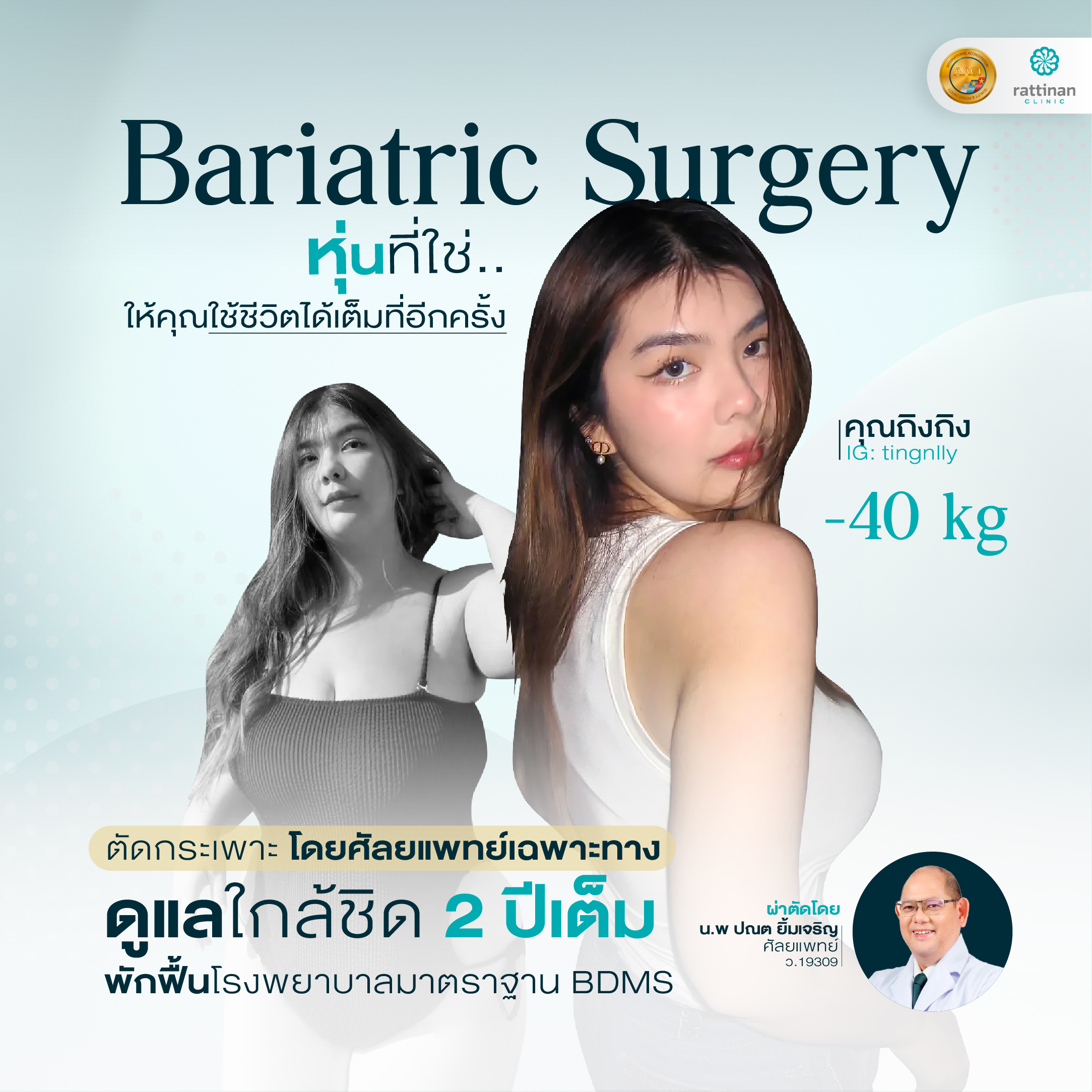 before after ตัดกระเพาะ คุณถิง_1