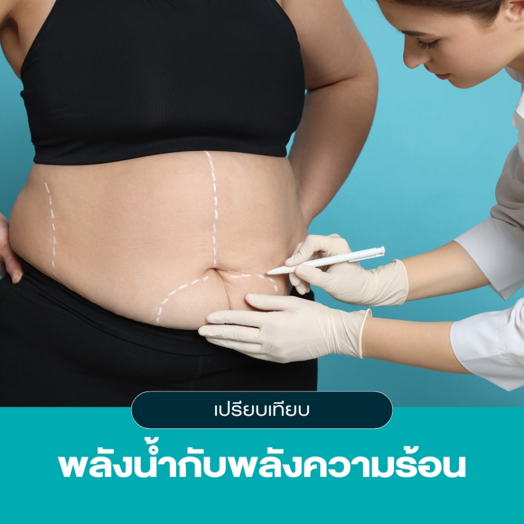 เปรียบเทียบพลังน้ำ VS พลังความร้อน