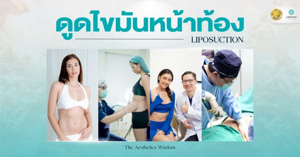ดูดไขมันหน้าท้อง