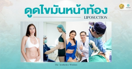 ดูดไขมันหน้าท้อง