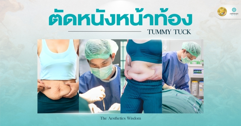 ตัดหนังหน้าท้อง