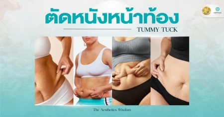 ตัดหนังหน้าท้อง