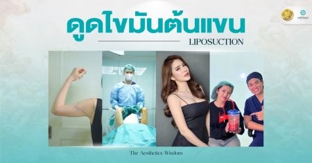 ดูดไขมันต้นแขน