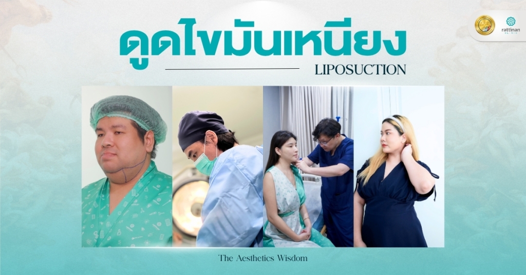 ดูดไขมันเหนียง