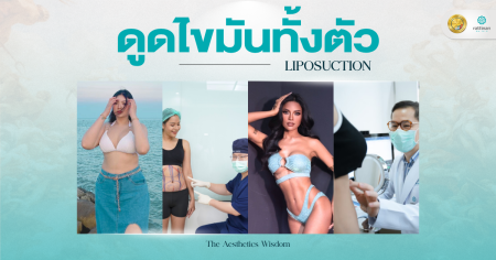 ดูดไขมันทั้งตัว
