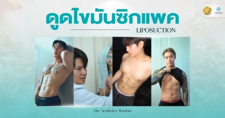 ดูดไขมันซิกแพค ราคา