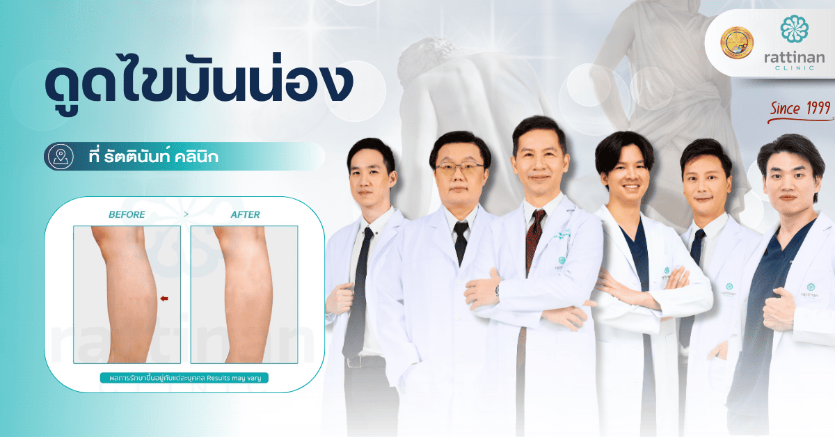ดูดไขมันน่อง