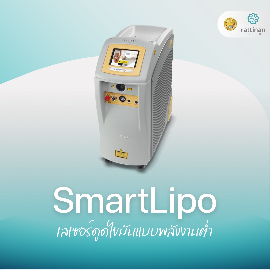 SmartLipo เลเซอร์ดูดไขมันแบบพลังงานต่ำ