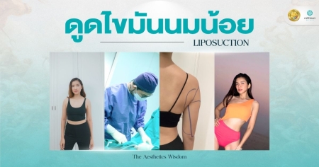 ดูดไขมันนมน้อย