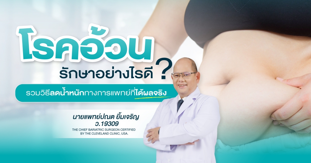 วิธีรักษาโรคอ้วน