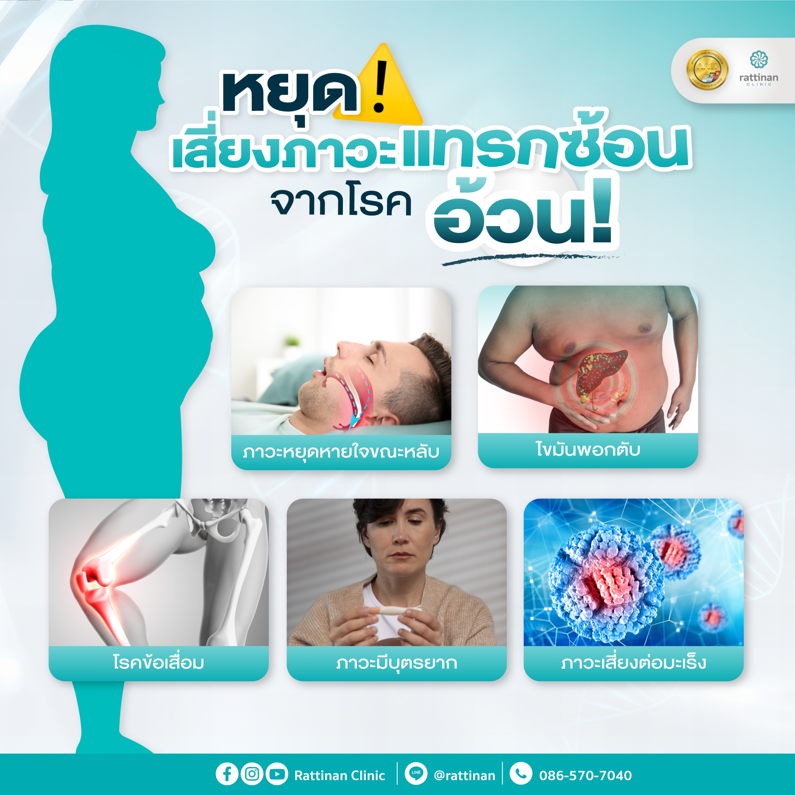 ภาวะแทรกซ้อนจากโรคอ้วน