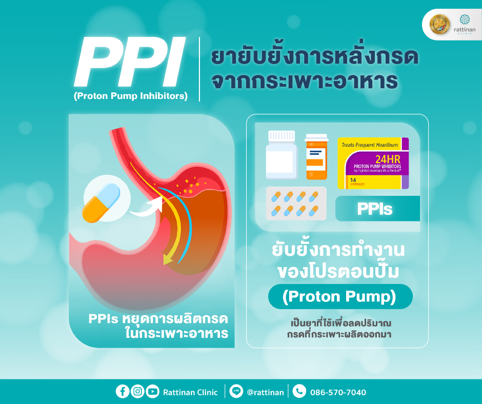 PPI (Proton Pump Inhibitors)