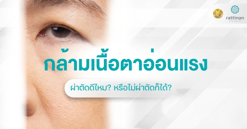 กล้ามเนื้อตาอ่อนแรง รักษา