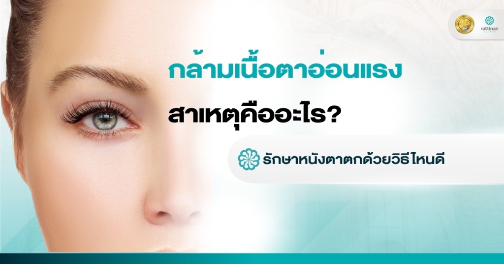 กล้ามเนื้อตาอ่อนแรง